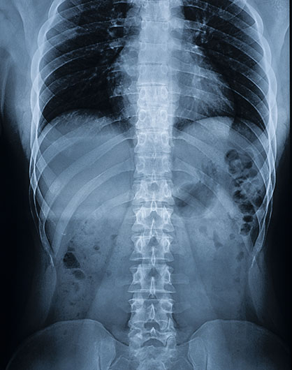 axis brain and back procedures